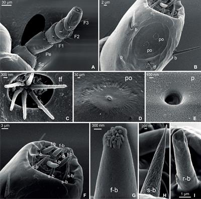 The Sensory Machinery of the Head Louse Pediculus humanus capitis: From the Antennae to the Brain